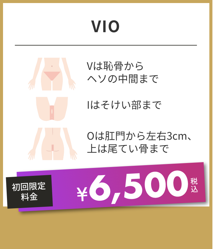 VIO