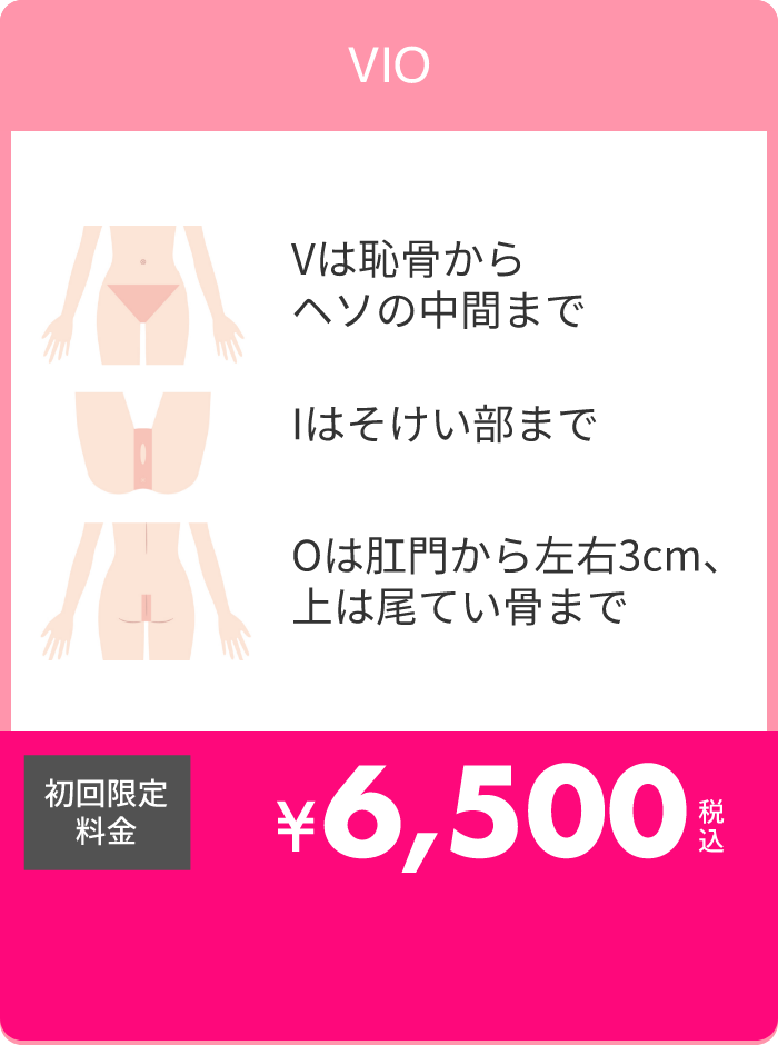 VIO